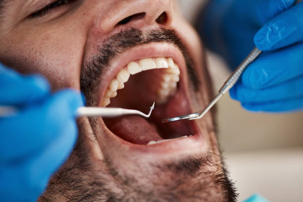 Best After-Hours Dental Trauma Care in Westover, WV