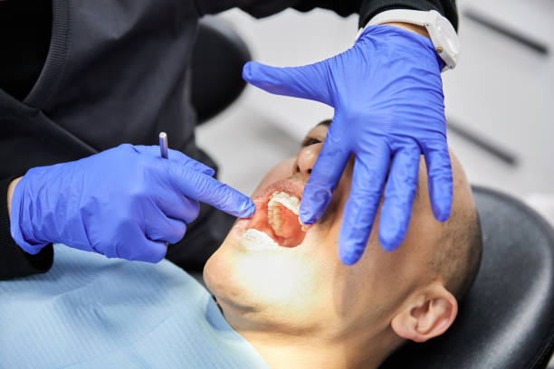 Best Emergency Gum Treatment in Westover, WV